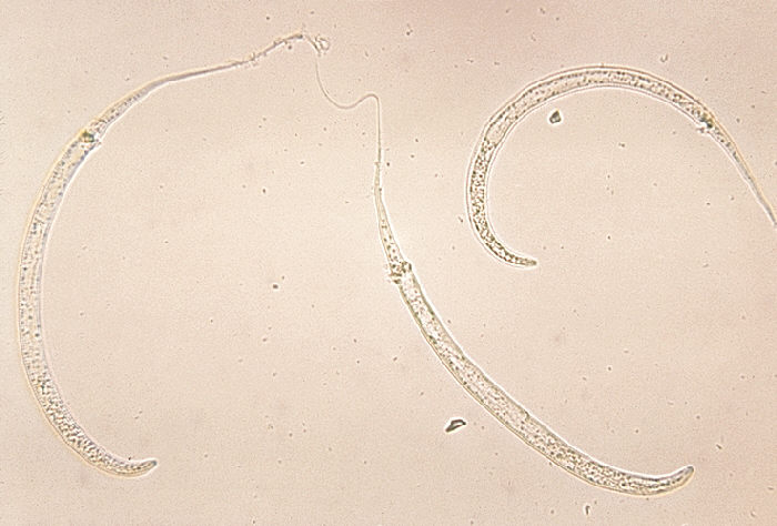 guineaWorm.jpg