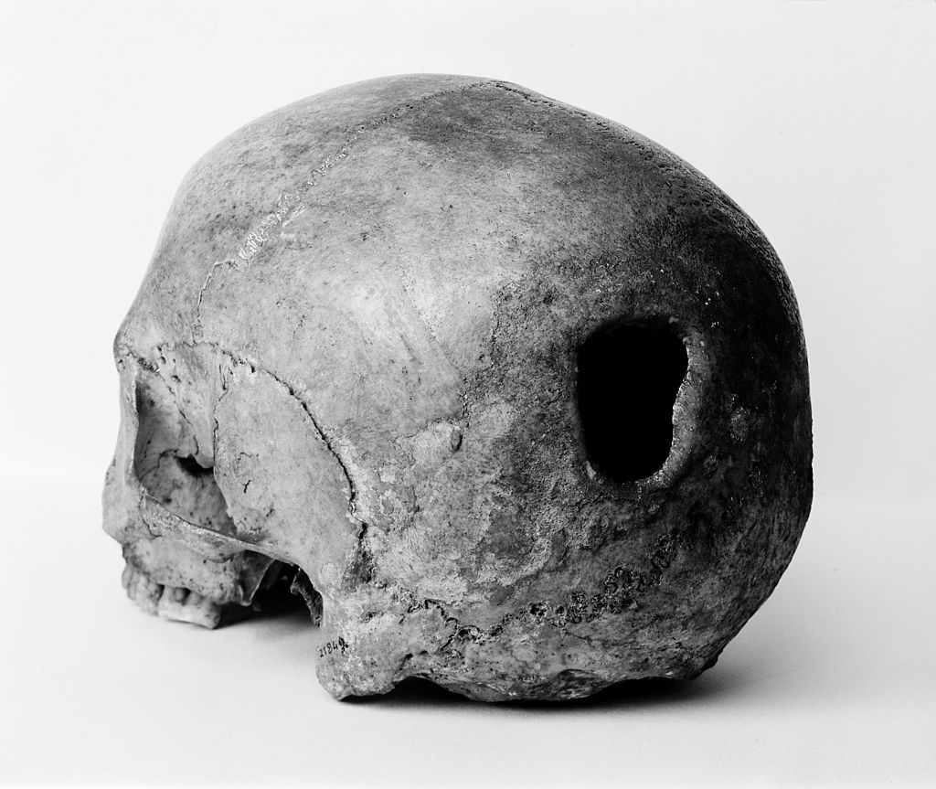 skull.jpg