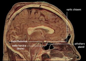 hypothalamus.jpg
