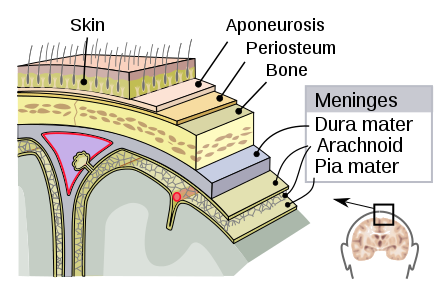 meningitis.png