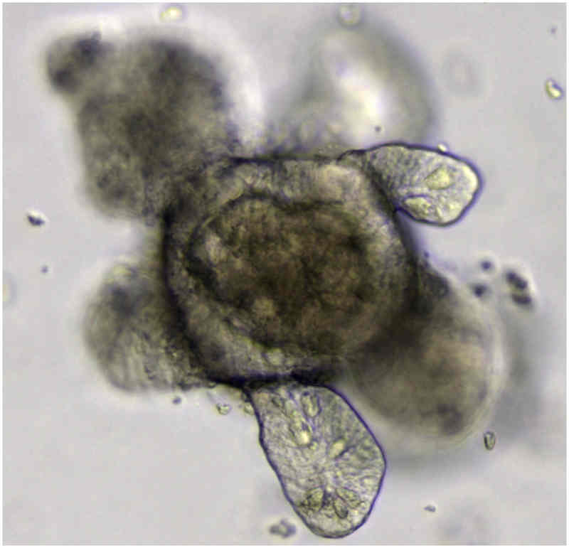 organoid.jpg