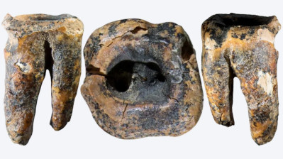 NeanderthalDentistry.jpg